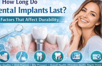 How Long Do Dental Implants Last? 6 Factors That Affect Durability