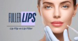 Lip Flip vs Lip Filler: What’s the Difference?